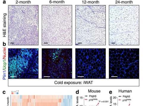 米色脂肪可能是与年龄相关的新陈代谢变化的关键