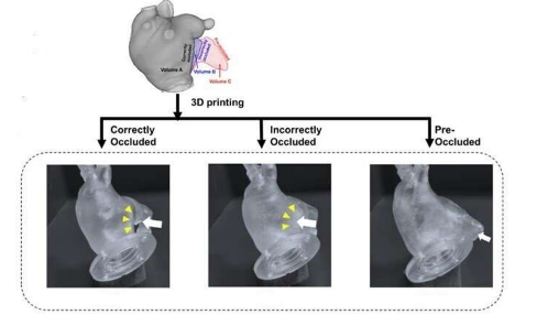 4D流式MRI 3D模体造福房颤患者