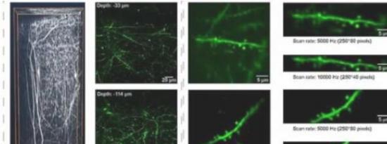 用于精确生物成像的新型高速双光子显微镜