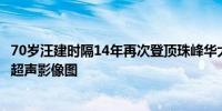 70岁汪建时隔14年再次登顶珠峰华大智造完成首张世界之巅超声影像图